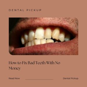 How-to-Fix-Bad-Teeth-With-No-Money