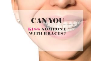 Can You Kiss Someone With Braces