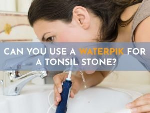 Can You Use A Waterpik For A Tonsil Stone