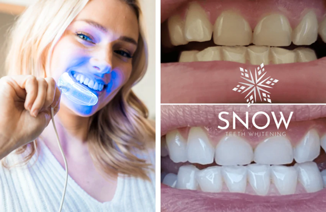 Snow Teeth Whitening Customer Reviews and testimonials