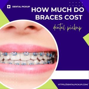 How-Much-Do-Braces-Cost