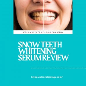 Snow-Teeth-Whitening-Serum-Review