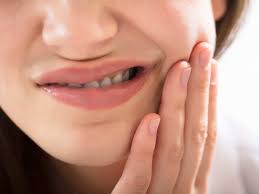 Tooth-sensitivities