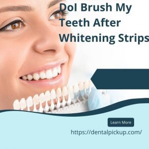 do-i-brush-my-teeth-after-whitening-strips