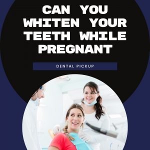 Can-You-Whiten-Your-Teeth-While-Pregnant