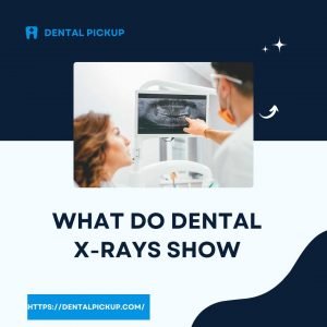 What-do-dental-x-rays-show