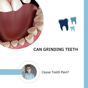 Can Grinding Teeth Cause Tooth Pain?