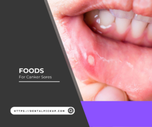 Foods For Canker Sores