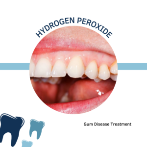 Hydrogen Peroxide Gum Disease Treatment