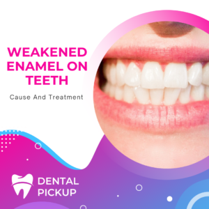 Weakened Enamel on Teeth