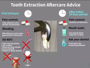 What to do after Tooth Extraction
