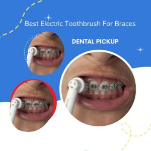 Best-Electric-Toothbrush-For-Braces