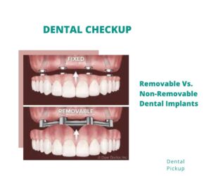 Removable-Vs.-Non-Removable-Dental-Implants