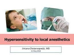 Treatment-Of-Anaesthetic-Allergy.